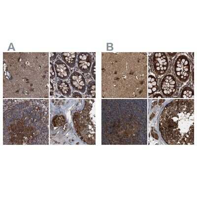 Immunohistochemistry-Paraffin: PEX5 Antibody [NBP2-38443]