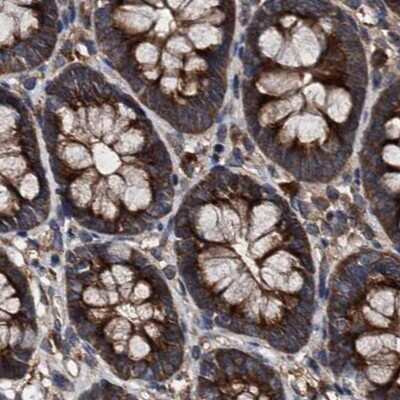 Immunohistochemistry-Paraffin: PEX5 Antibody [NBP2-38443]