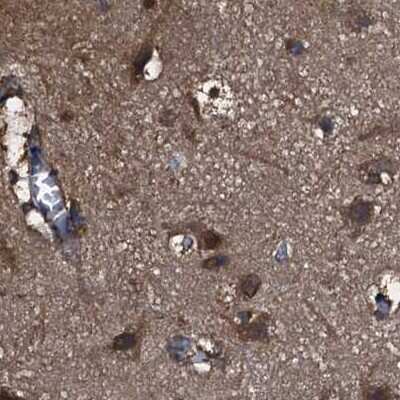 Immunohistochemistry-Paraffin: PEX5 Antibody [NBP2-38443]