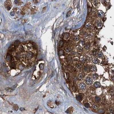 Immunohistochemistry-Paraffin: PEX5 Antibody [NBP2-38443]