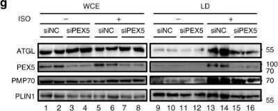 Knockdown Validated: PEX5 Antibody [NBP2-38443]