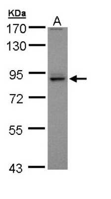 Western Blot: PEX5 Antibody [NBP1-32782]