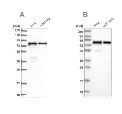 Western Blot: PEX5 Antibody [NBP1-87185]