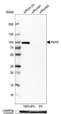 Western Blot: PEX5 Antibody [NBP2-38443]