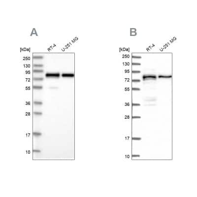 Western Blot: PEX5 Antibody [NBP2-38443]