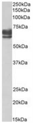 Western Blot: PEX5 Antibody [NBP2-44324]