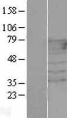 Western Blot: PEX5 Overexpression Lysate [NBL1-14304]