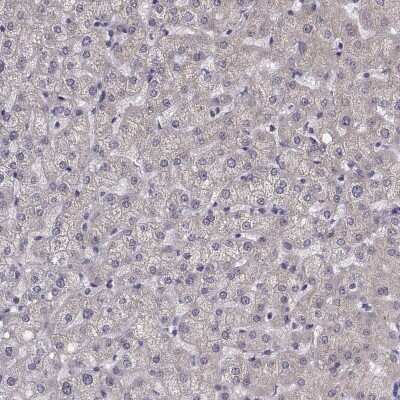 Immunohistochemistry-Paraffin: PEX5L Antibody [NBP2-38840]