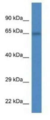 Western Blot: PEX5L Antibody [NBP1-91484]