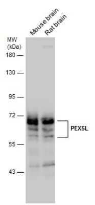 Western Blot: PEX5L Antibody [NBP3-13189]