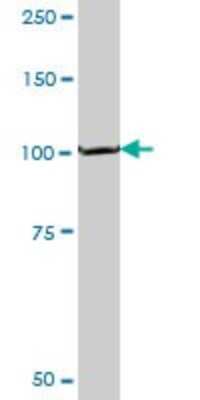 Western Blot: PEX6 Antibody (3G3) [H00005190-M04]