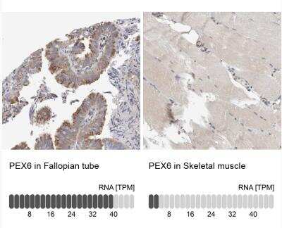 Immunohistochemistry-Paraffin: PEX6 Antibody [NBP1-80955]