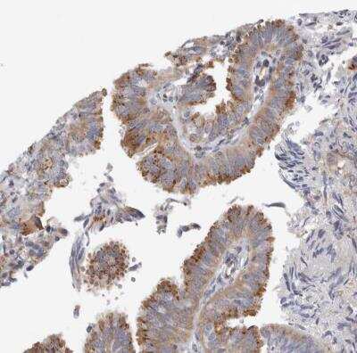 Immunohistochemistry-Paraffin: PEX6 Antibody [NBP1-80955]