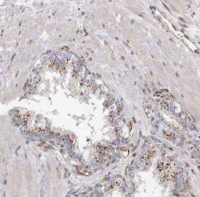 Immunohistochemistry-Paraffin: PEX6 Antibody [NBP1-80955]