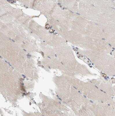 Immunohistochemistry-Paraffin: PEX6 Antibody [NBP1-80955]