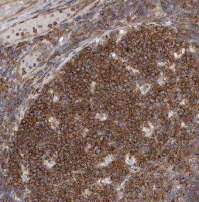 Immunohistochemistry-Paraffin: PEX6 Antibody [NBP1-80955]