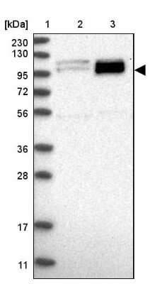 Western Blot: PEX6 Antibody [NBP1-80955]
