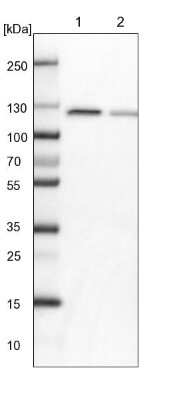Western Blot: PEX6 Antibody [NBP1-80955]