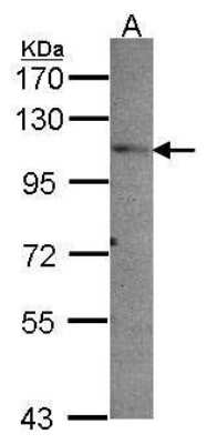 Western Blot: PEX6 Antibody [NBP2-43758]