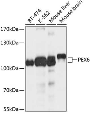 Western Blot: PEX6 AntibodyBSA Free [NBP2-93534]