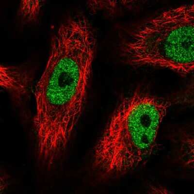 Immunocytochemistry/ Immunofluorescence: PF1 Antibody [NBP2-58148]