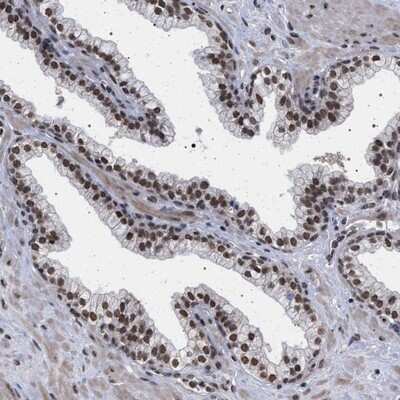 Immunohistochemistry-Paraffin: PF1 Antibody [NBP1-89599]