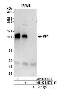 Immunoprecipitation: PF1 Antibody [NB100-81670]