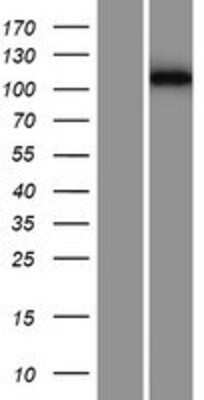 Western Blot: PF1 Overexpression Lysate [NBP2-11600]