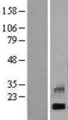 Western Blot: CXCL4/PF4 Overexpression Lysate [NBL1-14305]