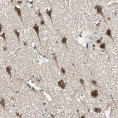 Immunohistochemistry-Paraffin: PFDN1 Antibody [NBP1-87294]