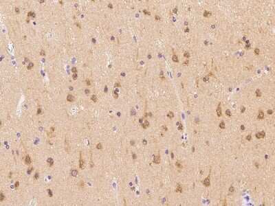Immunohistochemistry-Paraffin: PFDN1 Antibody [NBP2-97905]