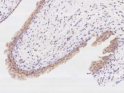 Immunohistochemistry-Paraffin: PFDN1 Antibody [NBP2-97905]