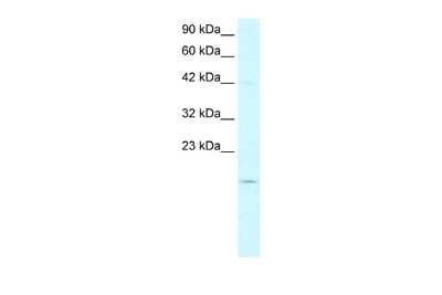 Western Blot: PFDN1 Antibody [NBP2-83384]