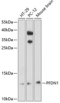 Western Blot: PFDN1 AntibodyAzide and BSA Free [NBP2-94786]