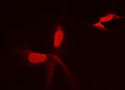 Immunocytochemistry/ Immunofluorescence: PFDN2 Antibody (04) [NBP3-06549]