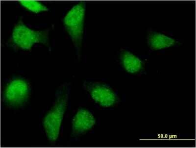 Immunocytochemistry/ Immunofluorescence: PFDN2 Antibody (2C1) [H00005202-M07]