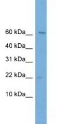 Western Blot: PFDN2 Antibody [NBP1-79641]