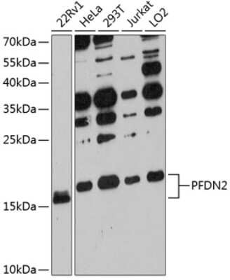 Western Blot: PFDN2 AntibodyAzide and BSA Free [NBP2-93963]