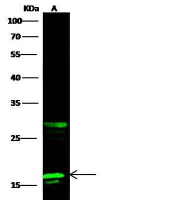 Western Blot: PFDN2 Antibody [NBP3-00279]