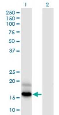 Western Blot: PFDN4 Antibody (2G4) [H00005203-M03]