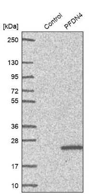 Western Blot: PFDN4 Antibody [NBP1-88526]