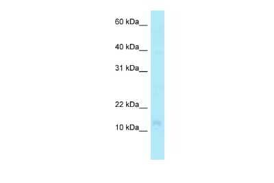 Western Blot: PFDN4 Antibody [NBP2-88039]