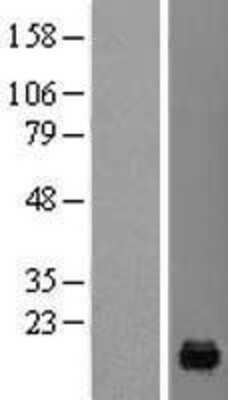 Western Blot: PFDN4 Overexpression Lysate [NBL1-14308]