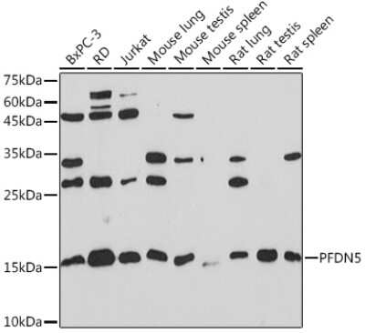 Western Blot: PFDN5 Antibody (9Y5H7) [NBP3-16331]