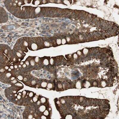 Immunohistochemistry-Paraffin: PFDN5 Antibody [NBP1-82639]