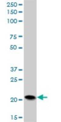 Western Blot: PFDN5 Antibody [H00005204-B03P]