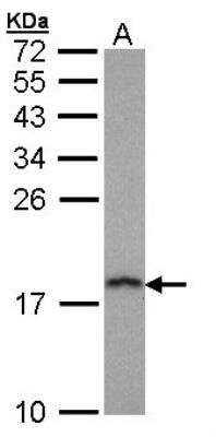 Western Blot: PFDN5 Antibody [NBP1-31643]