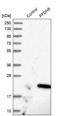 Western Blot: PFDN5 Antibody [NBP1-82639]