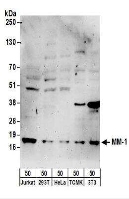 Western Blot: PFDN5 Antibody [NBP2-22337]