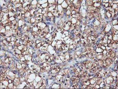 Immunohistochemistry-Paraffin: PFDN6 Antibody (OTI4E10) [NBP2-01637]